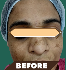 faceb
