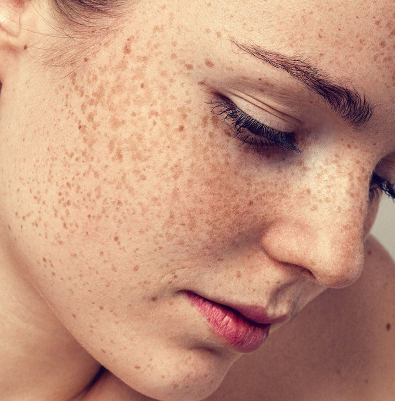 skin