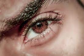 allergies